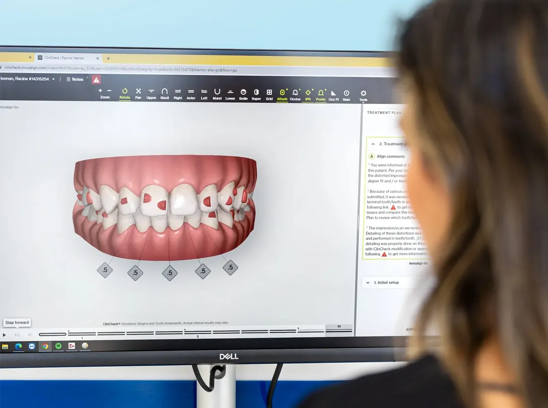 A patient looking at a 3D scan of her teeth on screen